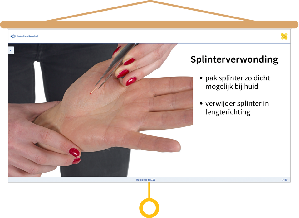 EHBO Presentatie Splinterverwonding