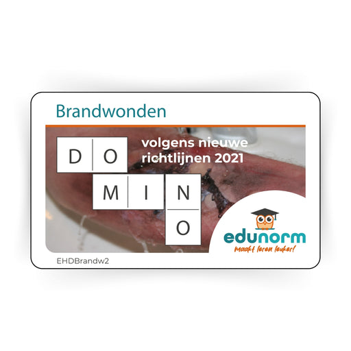 Dominospel brandwonden